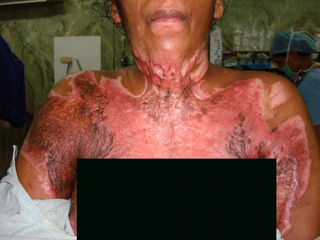 2nd picture Pre operation